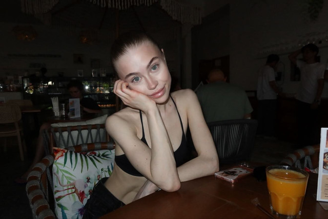 Relaxed Cafe Resort Style Editorial Photoshoot Pack: Candid Vacation Fashion Inspiration